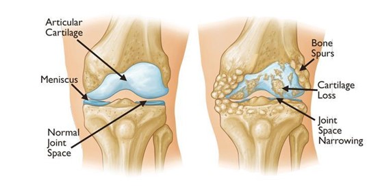 Are you experiencing knee pain?